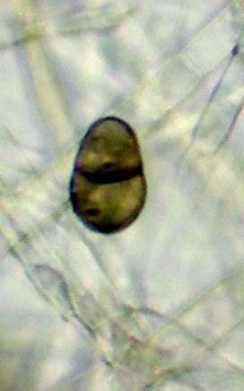 Conidie de Brachysporium nigrum Conidie de Brachysporium nigrum
