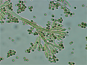 Conidie de Brachysporium nigrum