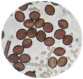 Spores de Chaetomium murorum