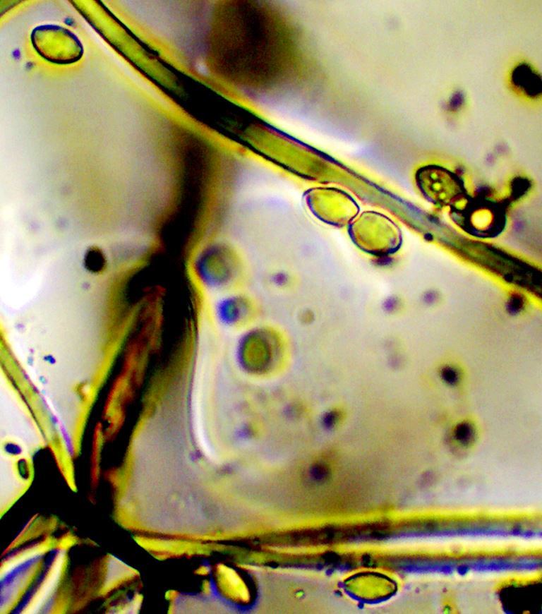 Spores de Coniophore