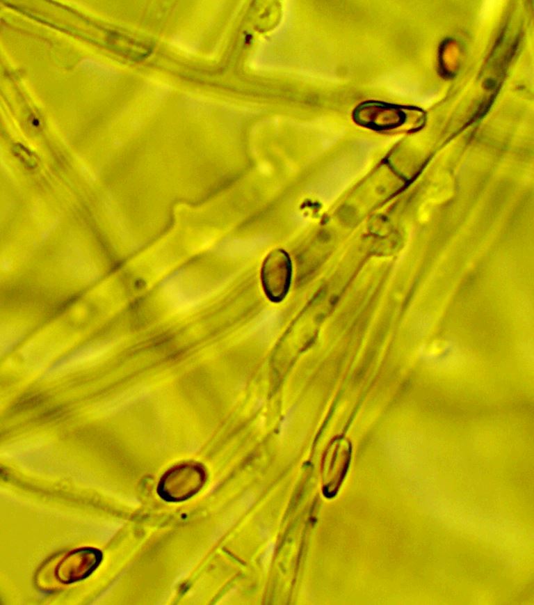 Spores et hyphes de Mrule